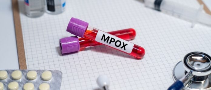 Ανησυχητική αύξηση κρουσμάτων mpox στην Αφρική με σοβαρές επιπτώσεις στη δημόσια υγεία